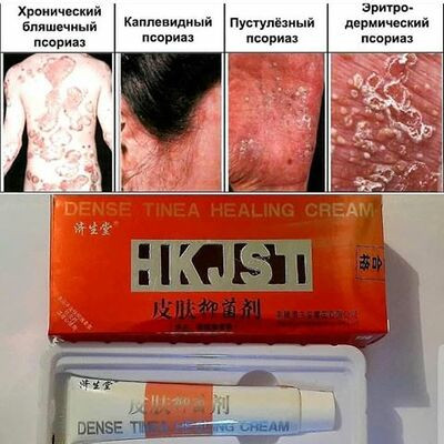 Крем от псориаза Dense tinea healing cream:uz:Psoriaz uchun zich tinea shifo kremi