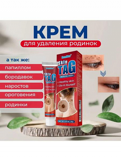 Крем для удаления бородавок и паппилом - 20 г  Skin Tag:uz:Siğil va papillomalarni olib tashlash uchun krem - 20 g teri yorlig'i