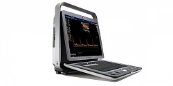 Portativ ultratovush apparati S9Exp.