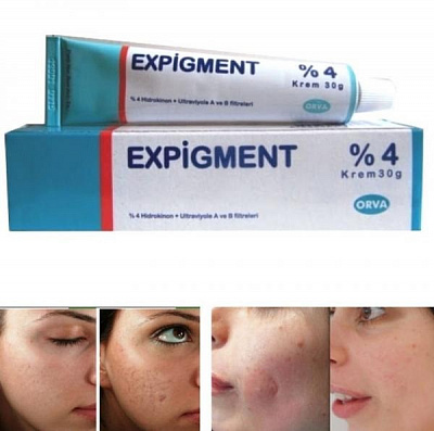 Отбеливающий крем EXPIGMENT 4:uz:EXPIGMENT 4 oqartiruvchi krem