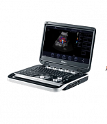 Portativ diagnostika ultratovush apparati Finus 50