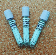 Vakuum trubkasi - K2 EDTA 13*75 2 ml