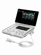 Portativ ultratovush apparati Esaote MyLab OMEGA